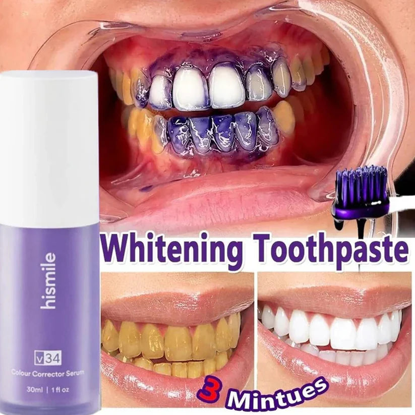 Hismile v34 Teeth Whitening Serum